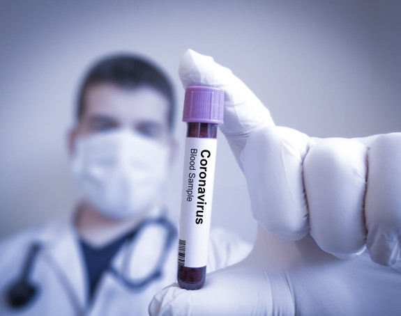 Srbija: Novih 412 osoba zaraženo, devet preminulo