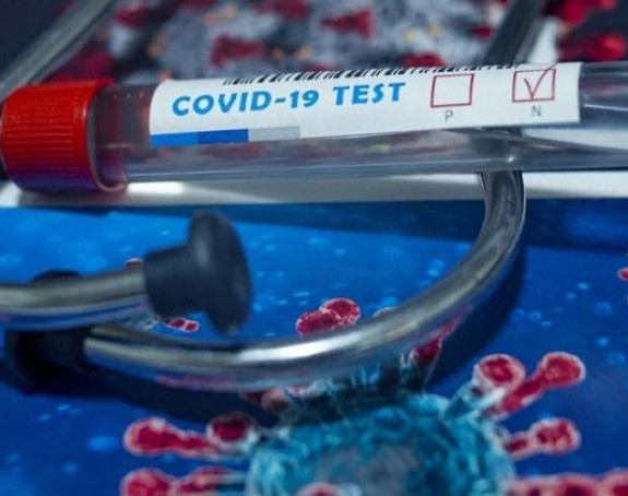 Srbija: Preko 400 novozaraženih, 10 osoba preminulo