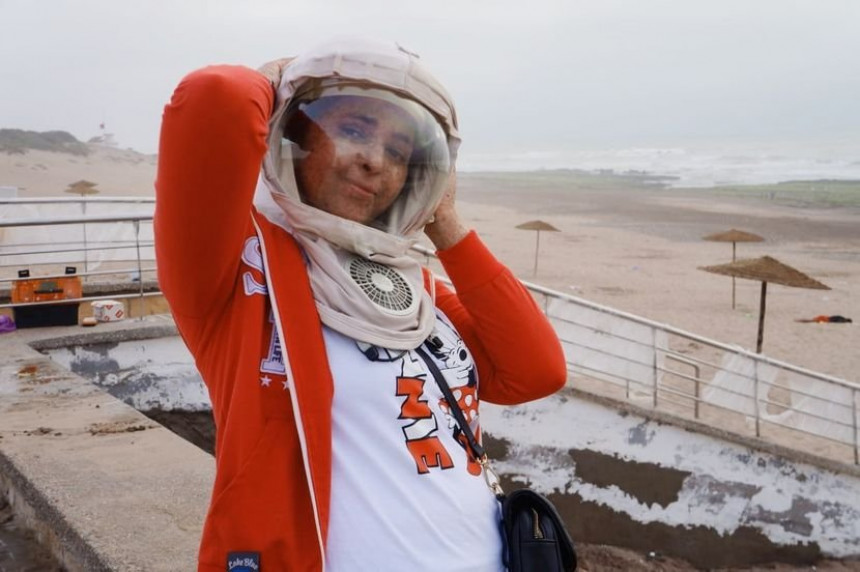 ŠOKANTNO: Devojka alergična na UV zrake mora da  nosi NASA kacigu!