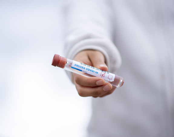 Do sada PCR test prošlo 48.589 građana Srpske