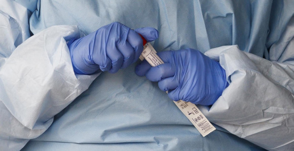 Novih 95 osoba u Srpskoj zaraženo, preminulo četvoro