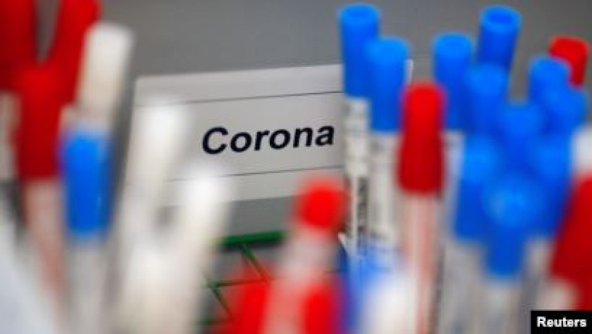 KS: Još 101 osoba zaražena, 81 iz porodičnog klastera