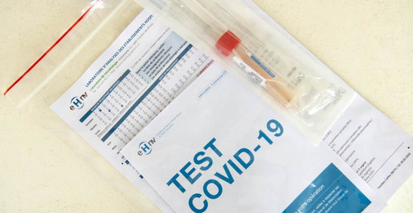 Uskoro: Do jeseni srpski test na korona virus