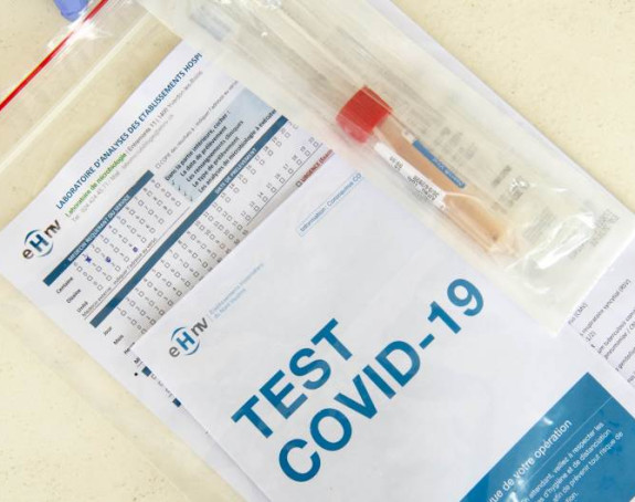 Uskoro: Do jeseni srpski test na korona virus