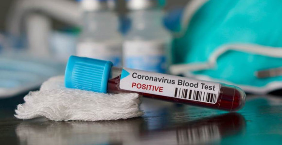 Virus: Peminuo pripadnik Oružanih snaga BiH