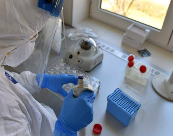 U Srbiji blago pada broj zaraženih virusom korona