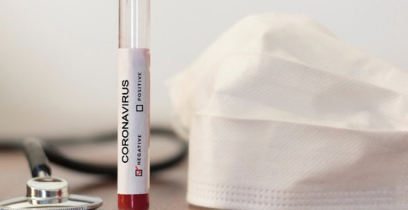 Direktor zeničke bolnice pozitivan na virus korona