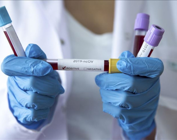 Korona ne posustaje: Za 24 časa preminulo 16 ljudi