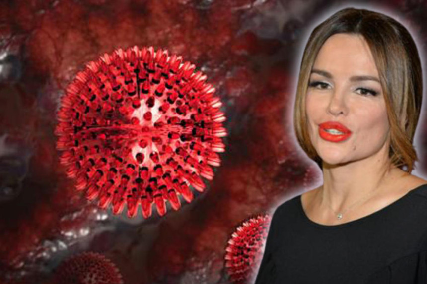 Severina objavila: Pozitivna sam na virus korona!