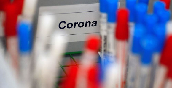 Počela proizvodnja ruske vakcine protiv korone