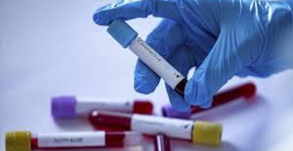 U Srbiji još 238 novih slučajeva korona virusa