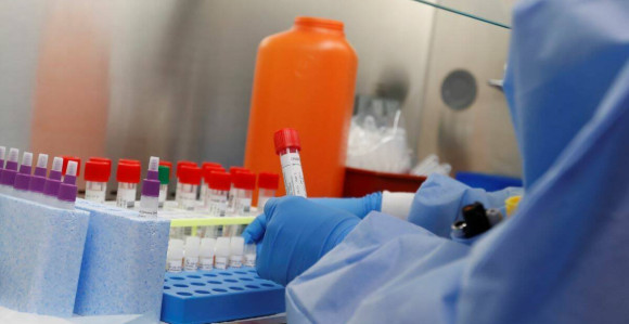 Raste broj: Još 146 osoba u Srpskoj zaraženo virusom