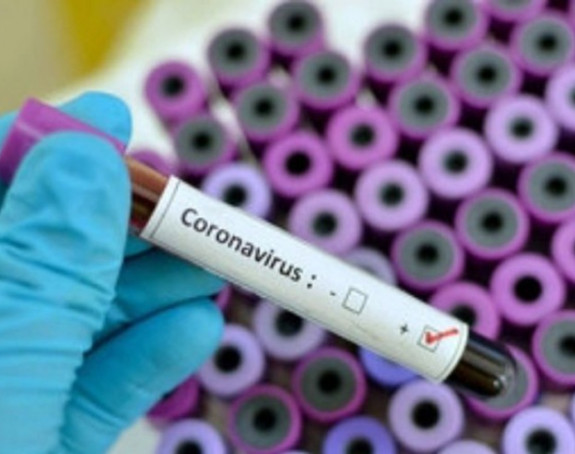 U Srbiji otkriven još 161 slučaj zaraze virusom