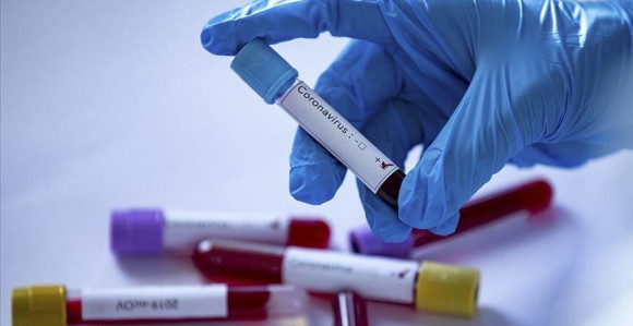 Od 7.261 testirane osobe pozitivno manje od 1%