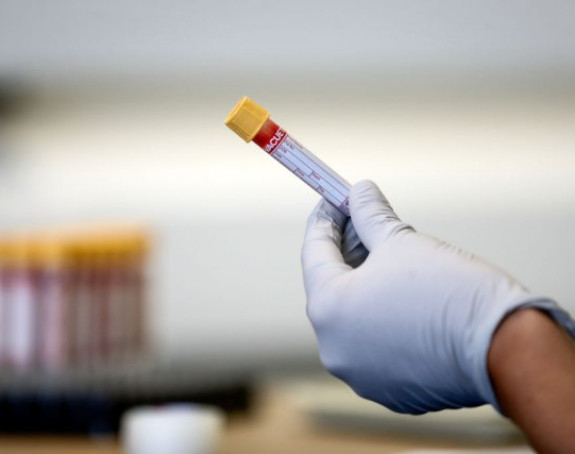 SAD uvode Rusiji sankcije zbog vakcine?!