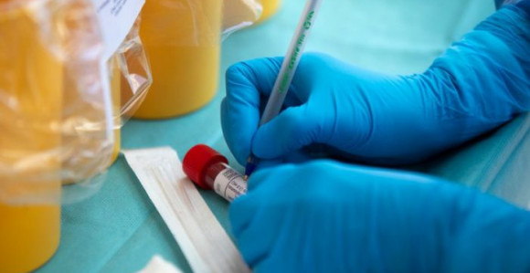 Kod još 57 osoba u Srpskoj potvrđen virus korona