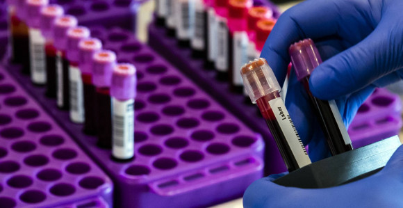 Blizu dvije hiljade testirano, 193 zaraženo