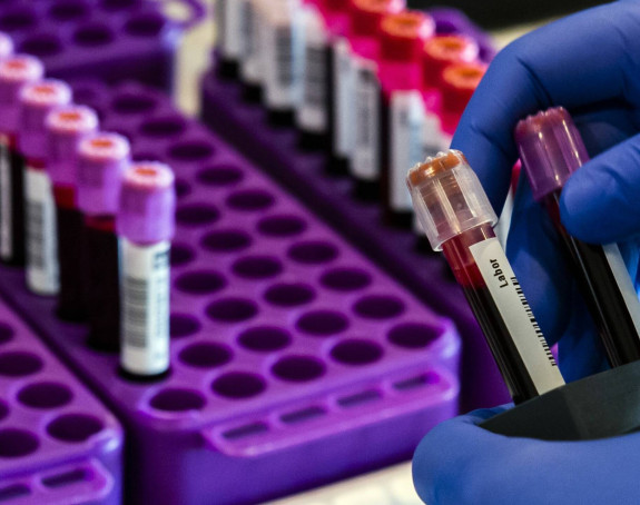 Blizu dvije hiljade testirano, 193 zaraženo