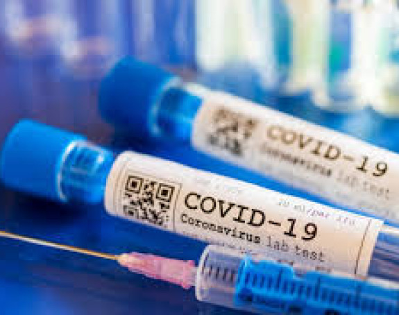 Virus korona je potvrđen kod još 73 osobe u Srpskoj