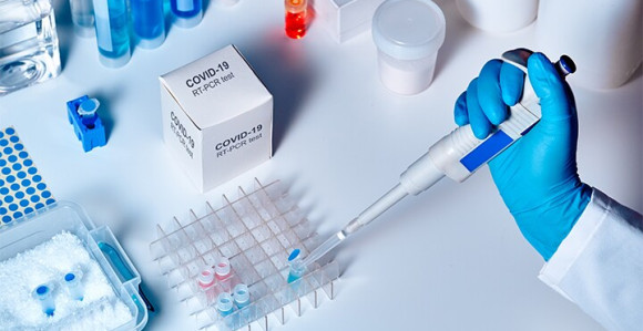 Od testiranih 357, pozitivno je 35 osoba u Srpskoj