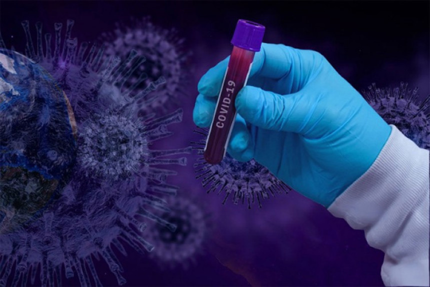 Тестирано 111 узорака, вирус корона потврђен код 16 особа