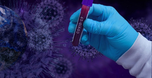 Testirano 111 uzoraka, virus korona potvrđen kod 16 osoba