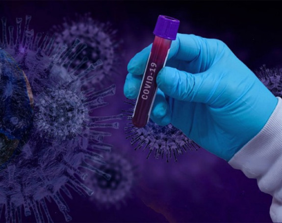 Testirano 111 uzoraka, virus korona potvrđen kod 16 osoba