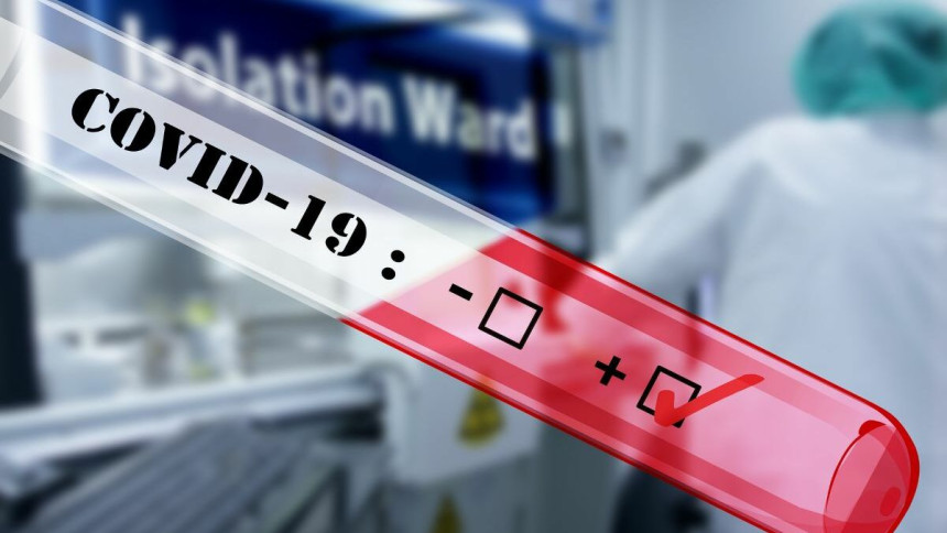 Virus korona potvrđen još kod 142 osobe u Srpskoj