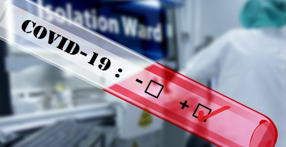Virus korona potvrđen još kod 142 osobe u Srpskoj
