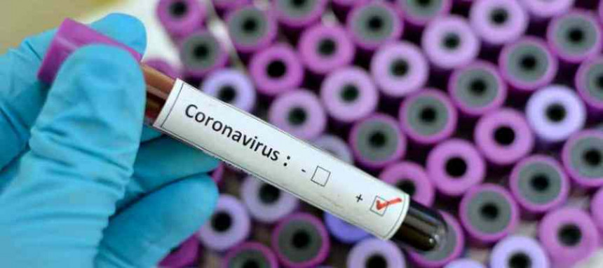 Blizu trista osoba zaraženih virusom korona u FBiH