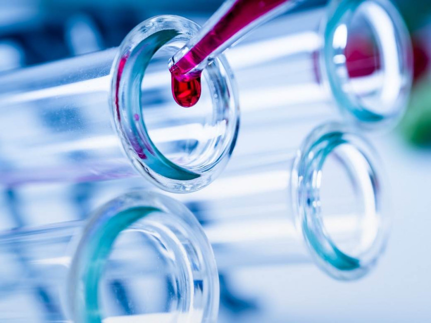 Virus korona potvrđen još kod 141 osobe u Srpskoj