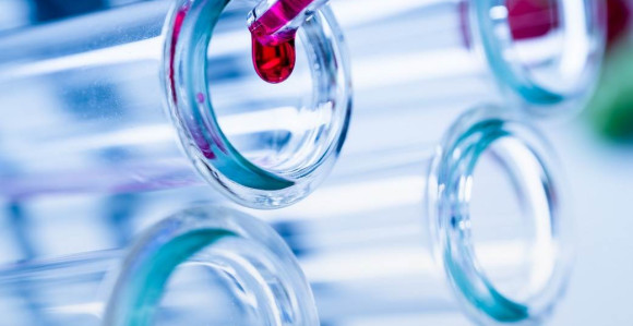 Virus korona potvrđen još kod 141 osobe u Srpskoj
