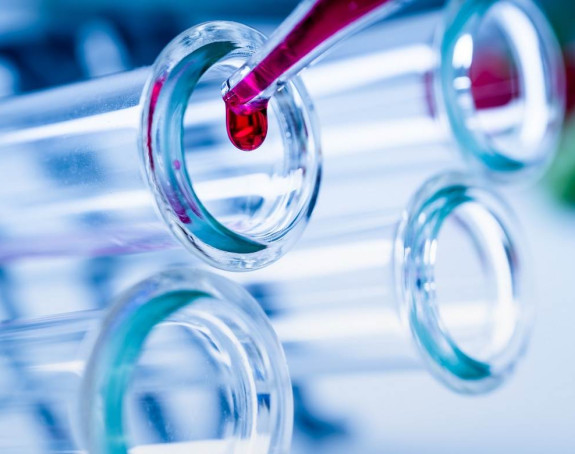 Virus korona potvrđen još kod 141 osobe u Srpskoj
