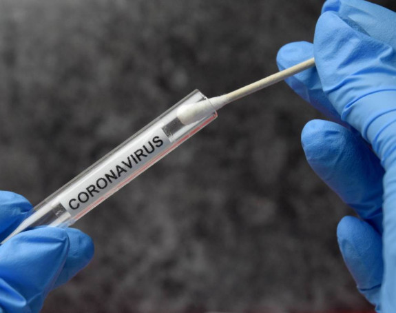 У Федерацију БиХ регистрован 371 нови случај вируса