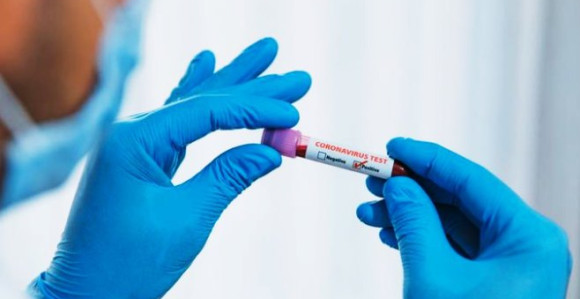 Virus potvrđen kod još 485 osoba u Federaciji BiH