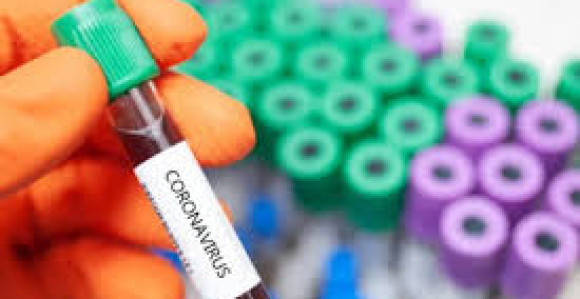 Virus korona potvrđen kod još 582 оsоbe u Rеpublici Srpskој