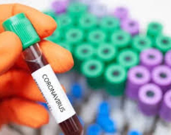 Virus korona potvrđen kod još 582 оsоbe u Rеpublici Srpskој
