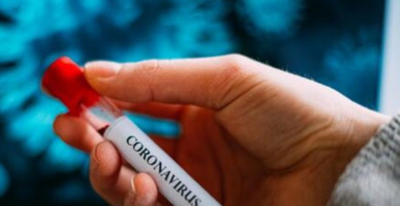 U Srbiji još 614 novozaraženih, troje preminulo