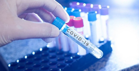 Crna Gora: 2.500 uzoraka čeka na testiranje