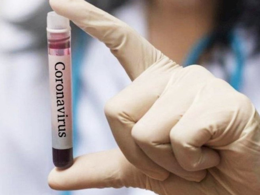 Crna Gora: Preminule 4 osobe, još 320 zaraženo