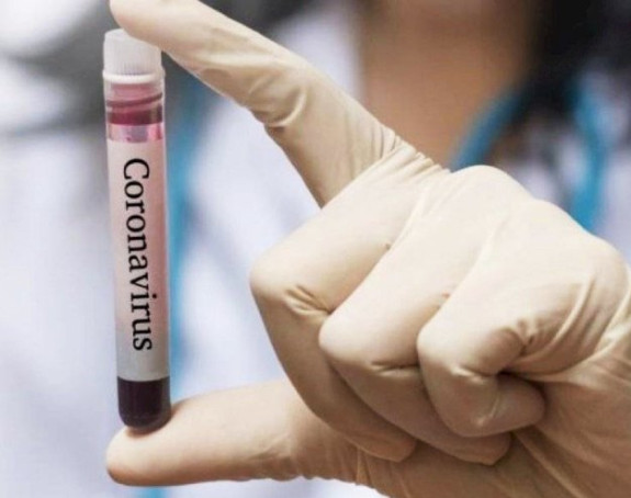 Crna Gora: Preminule 4 osobe, još 320 zaraženo