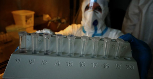 U Srbiji deset preminulih, 2.112 novozaraženih