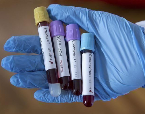 Virus korona u FBiH potvrđen kod 805 novooboljelih osoba