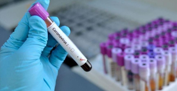 Virus korona potvrđen kod još 416 osoba u Srpskoj