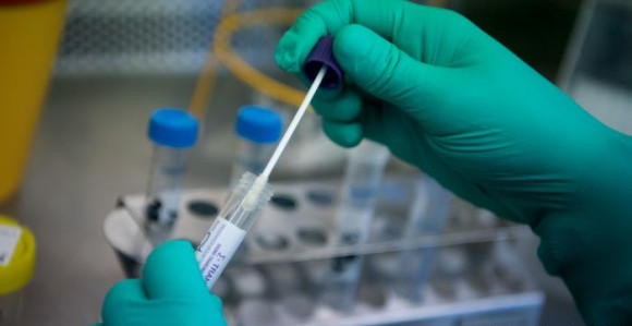 Virus potvrđen kod još 412 osoba u Republici Srpskoj