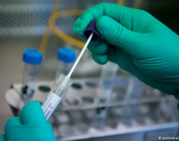 Virus potvrđen kod još 412 osoba u Republici Srpskoj