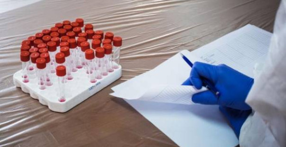 U BiH još 526 osoba pozitivno na virus korona