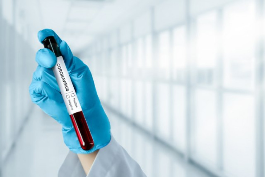 Otkriven novi oblik virusa koji izaziva Kovid-19