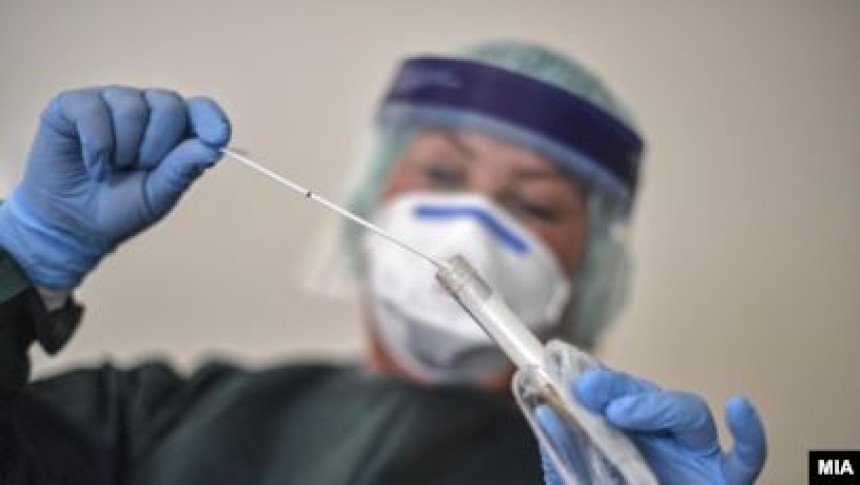 Virus korona potvrđen kod 262 osobe u Srpskoj
