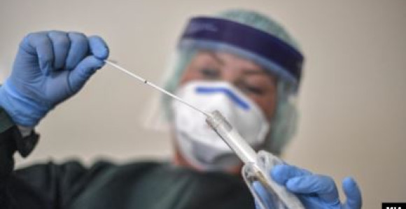 Virus korona potvrđen kod 262 osobe u Srpskoj